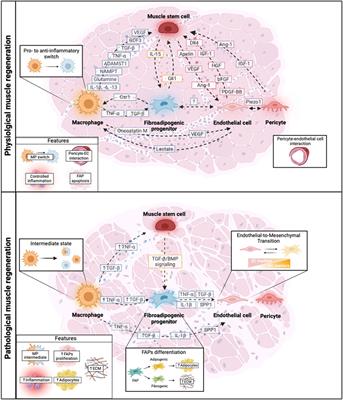 Cellular interactions and microenvironment dynamics in skeletal muscle regeneration and disease